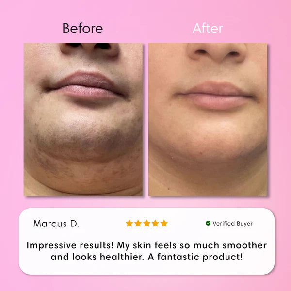 Hair Removal Kit