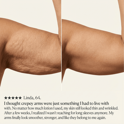 Crepey Skin Repair Cream