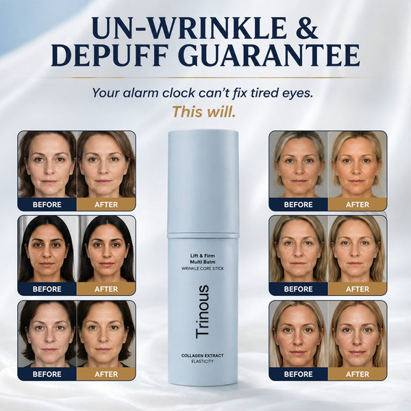 trinous - Korean Under Eye Balm