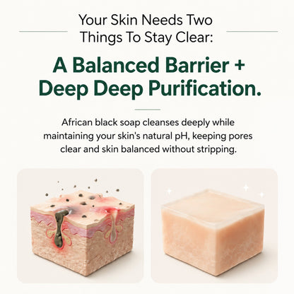 Pure Nilotica Shea Butter by Viralaluna™