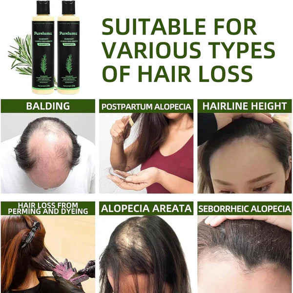 trinous Rosemary Shampoo