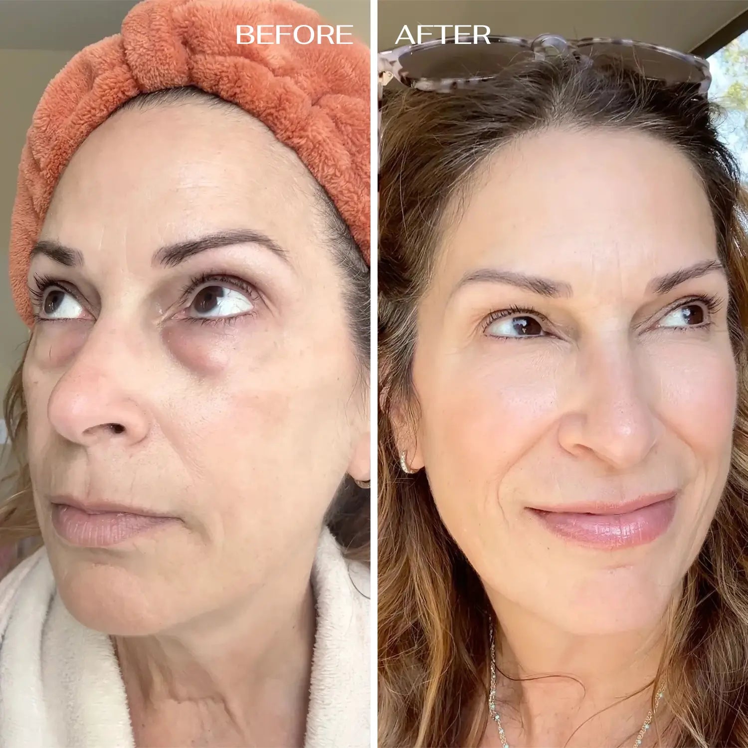 ALL-IN-ONE BALM FOR UNDER-EYE RENEWAL